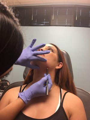 Kybella for treatment of double chin.