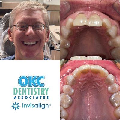 Do you want to enhance your smile?  We can help you with invisalign!  Call today!