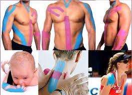 Advanced kinesio taping