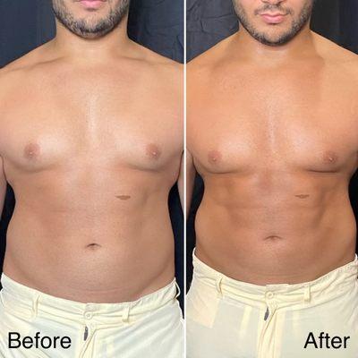 Airbrush spray tanning before and after