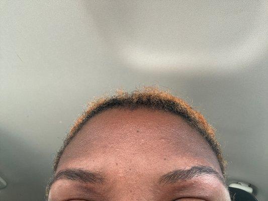 What is this??? One portion of my brows is bald and it's uneven.