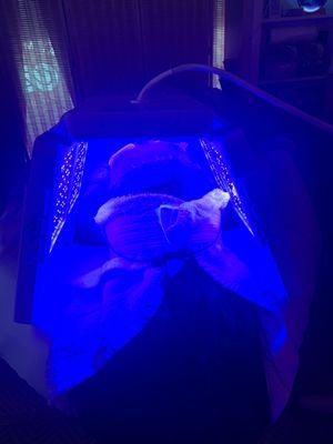 LED (Blue) Lightwave Facial Treatment: Controls P-acnes bacteria (Propionibacterium acnes)