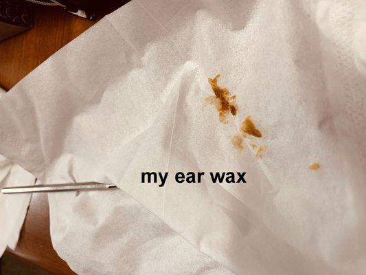 It's amazing the difference having the wax cleaned out of your ears makes. Patty is excellent at doing this painlessly.