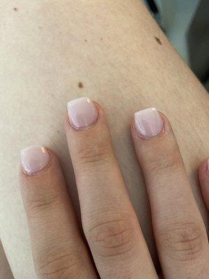 Big gap between nails and skin