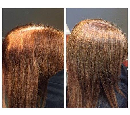 Color correction on a box dye malfunction.