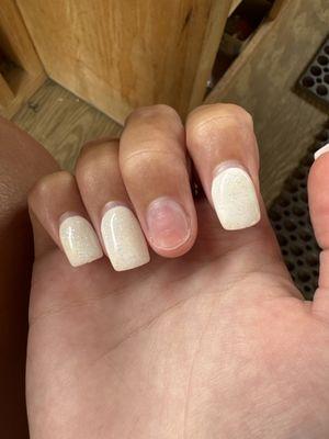 nail that fell off