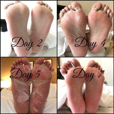 Did the Ultimate Foot Care! It's CRAZY! Better than any pedicure you'll ever get!