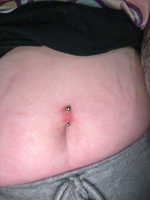 Heres what my piercing looks like three months later. No salt. So they can't even say that this is burning.