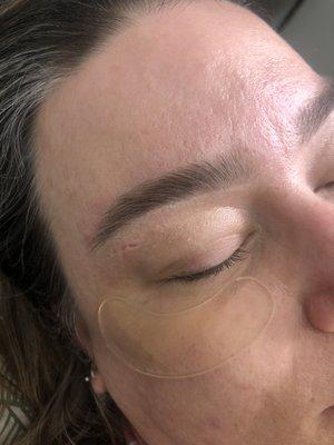 Brow shaping