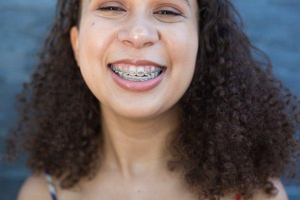 NCOSO Patient with Traditional Braces