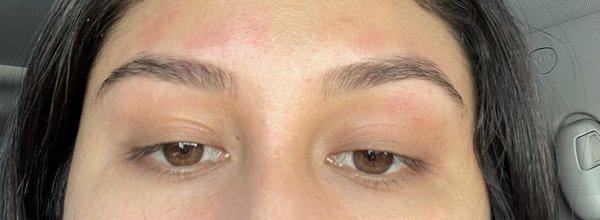 The left side is so much thicker in the beginning than my right side. She left red bumps all over my forehead.