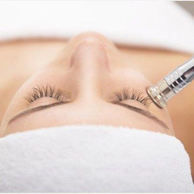 Microdermabrasion