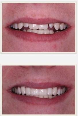 Cosmetic Dentistry Long Beach 
Dr. Hong T. Vu DDS  is known for providing smile makeovers.