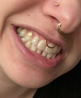 My smile with tooth gems from Stay Flossy SD