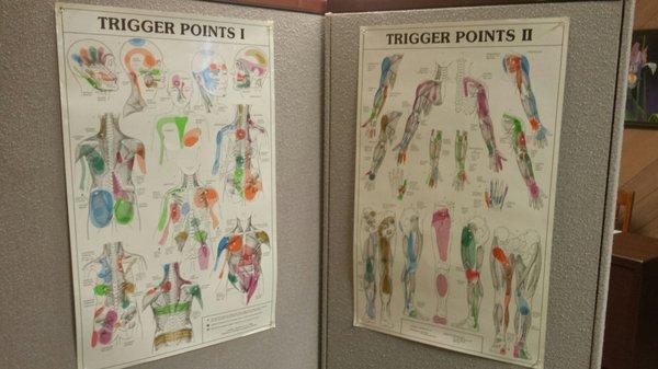 Trigger Point Charts that show referred pain patterns