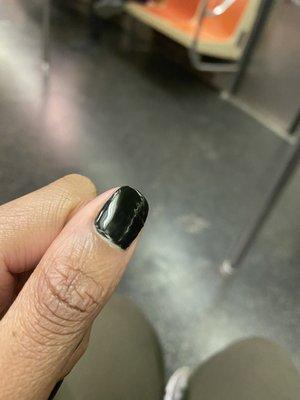 Same side of yuck nail.