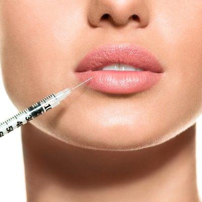 DERMAL FILLERS