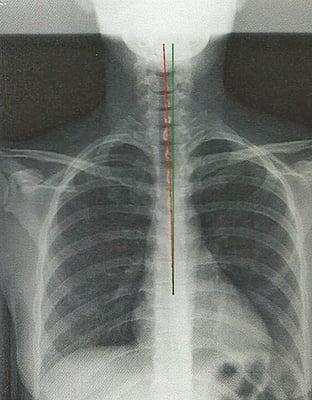 My x-ray front view.