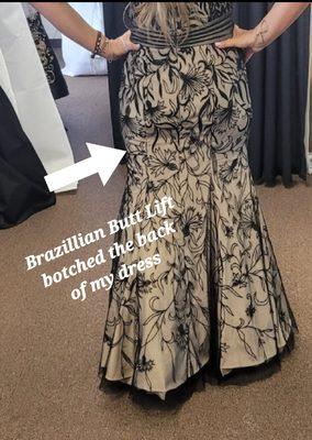 Brazilian Butt Lift ruined the integrity of this beautiful dress.