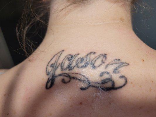 Arizona Tattoo Removal