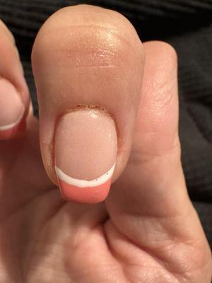 Scab from cuticles being filed, uneven lines