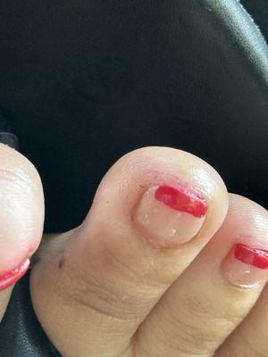 Horrible pedicure