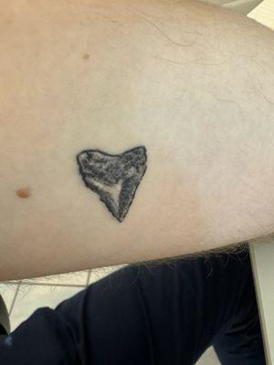 Shark tooth done 08/29/24