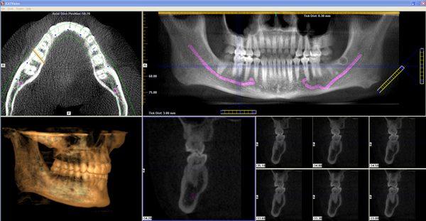 Honolulu prosthodontist