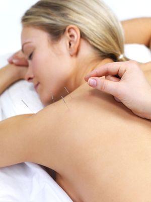 Acupuncture for postpartum recovery.