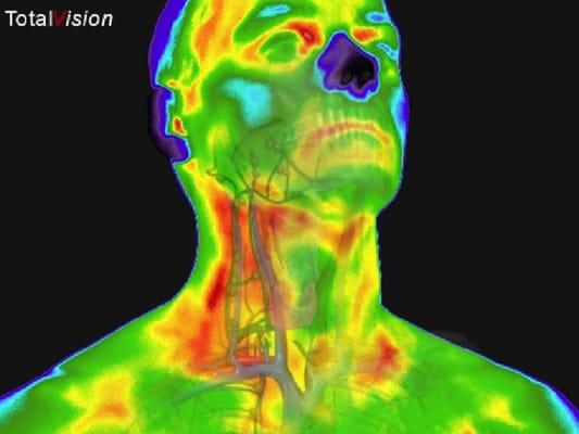 Example image of thyroid and carotid arteries. these scans are used to monitor plaque buildup in the arteries, as well as thyroid efficiency