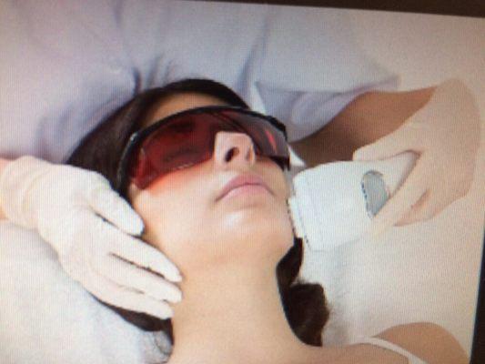 IPL Photo facial Laser Treatments