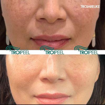 TROIAREUKE California | Buena Park, California | Skin Care | Naturally Rebuild Your Skin from the Inside Out