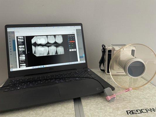 We take comprehensive digital X-rays on all patients to allow for proper diagnosing and referrals if there are any concerns.