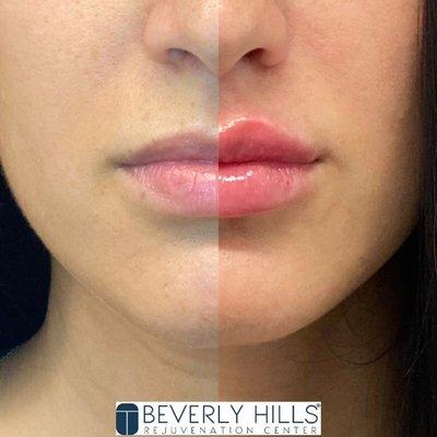 Beverly Hills Rejuvenation Center - Valencia