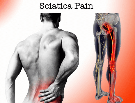 Sciatic pain