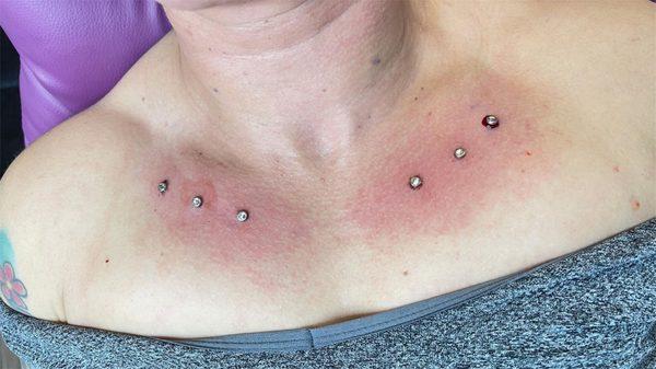 dermals! dermal! dermals!