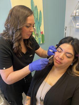 Christina injecting undereye with Restylane classic using a cannula. This is a very safe technique and helps with volume loss under eye.