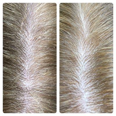 Before and after scalp detox