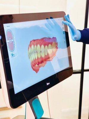 Our itero allows us to forgo traditional dental impressions and opt for a comfortable and digital experience for you!