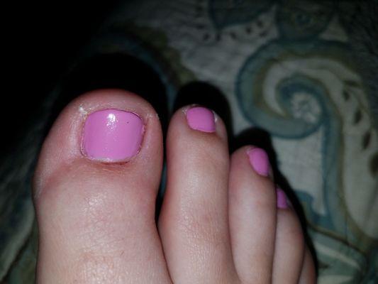 Pics or it didn't happen. My sore big toe cuticle bed post pedicure. My other foot is the same.