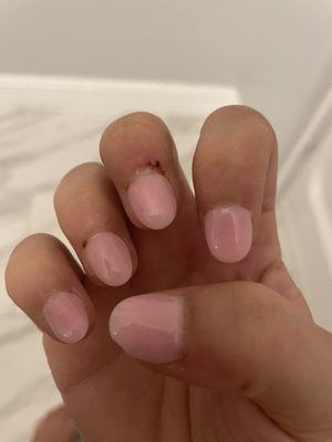 Bad nail job