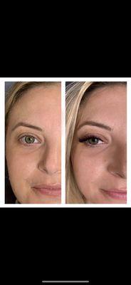 Amazing transformation. We used volume lash extensions to elongate the rounder features of her eye