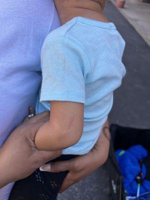 My niece got trampled on and scratched inside of the toddler jumper. Dad had to physically go inside and get her out himself.