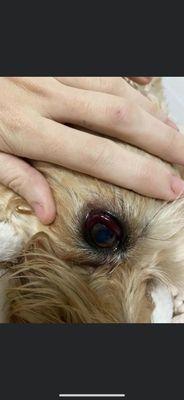 Conjunctival Hemorrhage due to blunt force trauma