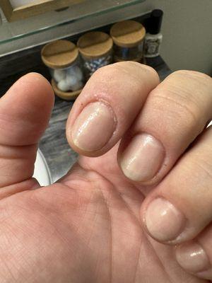 Gross worst manicure !!!