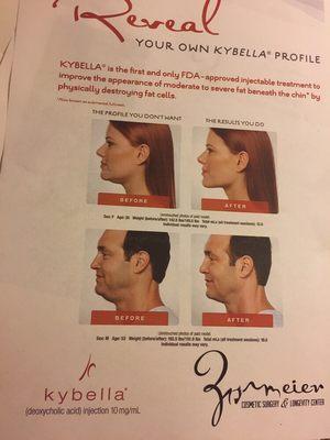 Kybella