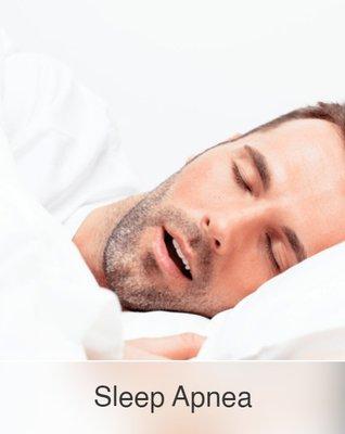 Sleep Apnea