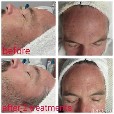 Organic photo facials...