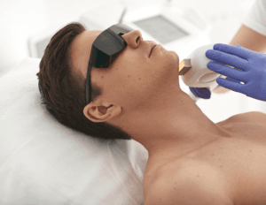 Laser hair removal