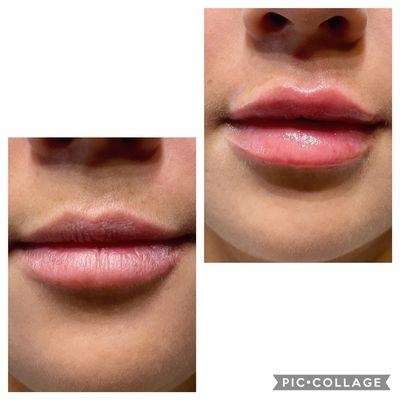 Love Kysse for lips!!!